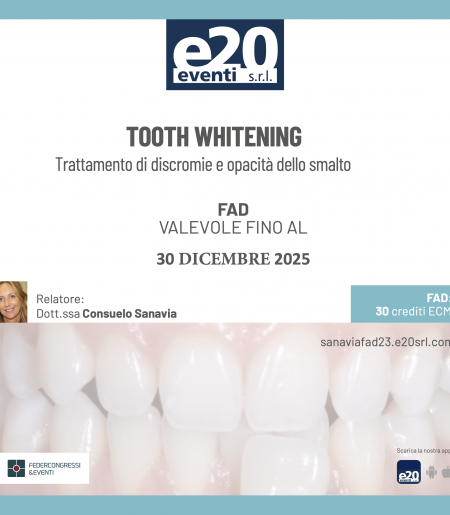 Dott.ssa Sanavia - TOOTH WHITENING: Trattamento di discromie e opacità dello smalto