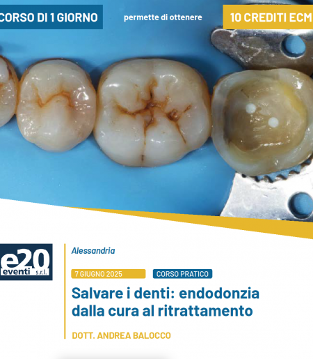 Dott. Balocco - SALVARE I DENTI: Endodonzia dalla cura al ritrattamento - ALESSANDRIA