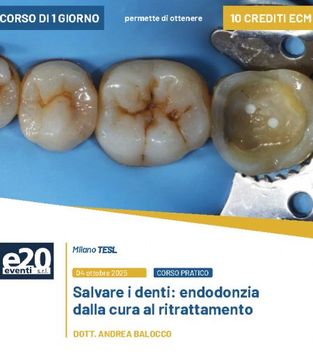 Dott. Balocco - SALVARE I DENTI: Endodonzia dalla cura al ritrattamento - MILANO