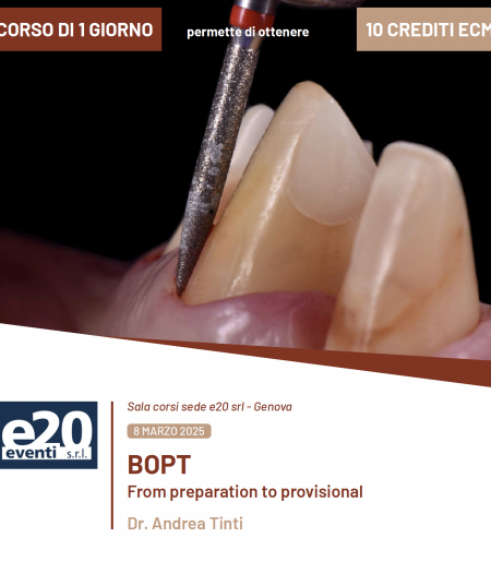 Dott. Andrea Tinti - BOPT From preparation to provisional - GENOVA