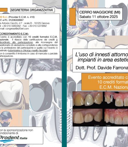 L’uso di innesti attorno a impianti in area estetica - Dott. Prof. Davide Farronato